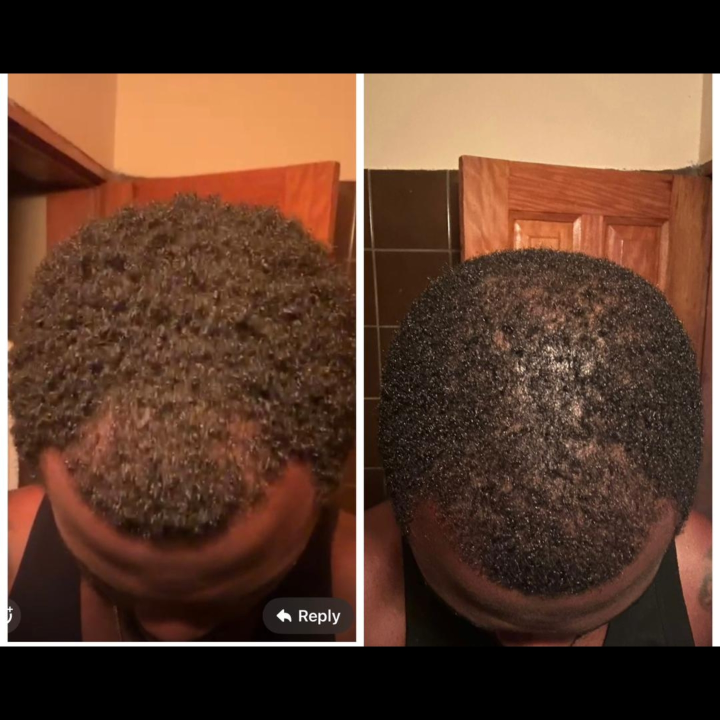 WOLF GAINS HAIR GROWTH