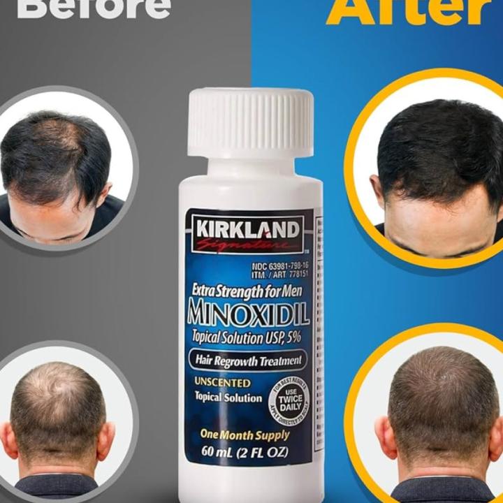 Kirkland Minoxidil Hair Regrowth for Men