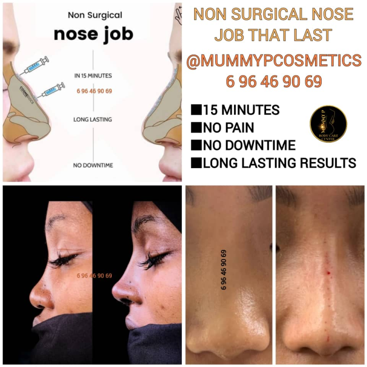 Nose Fillers