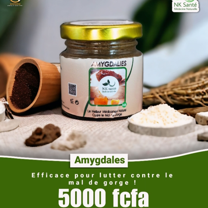 AMIGDALY