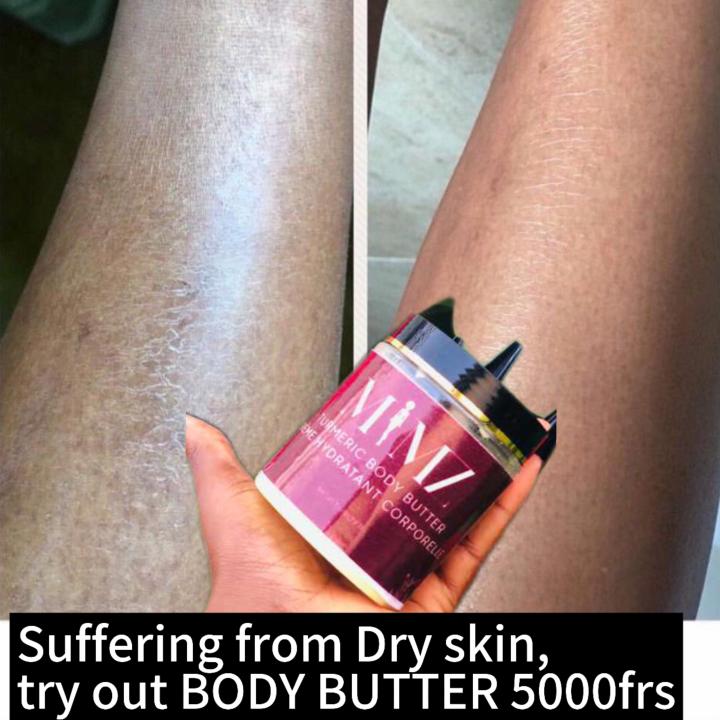 SKIN MOISTURIZING BUTTER
