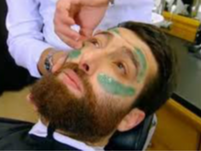 Épilation barbe