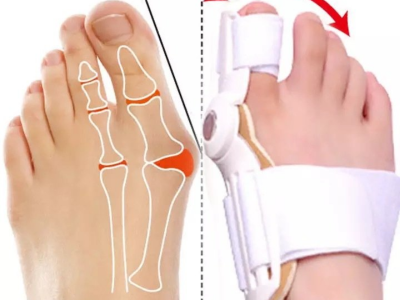 Toe adjuster