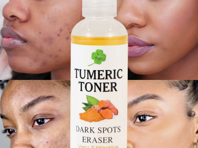 Dark Spot Remover Tumeric Toner