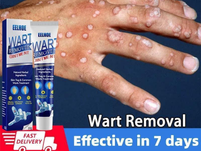 Wart Removal