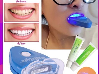 Teeth whitening