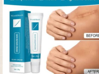 Scar repair cream