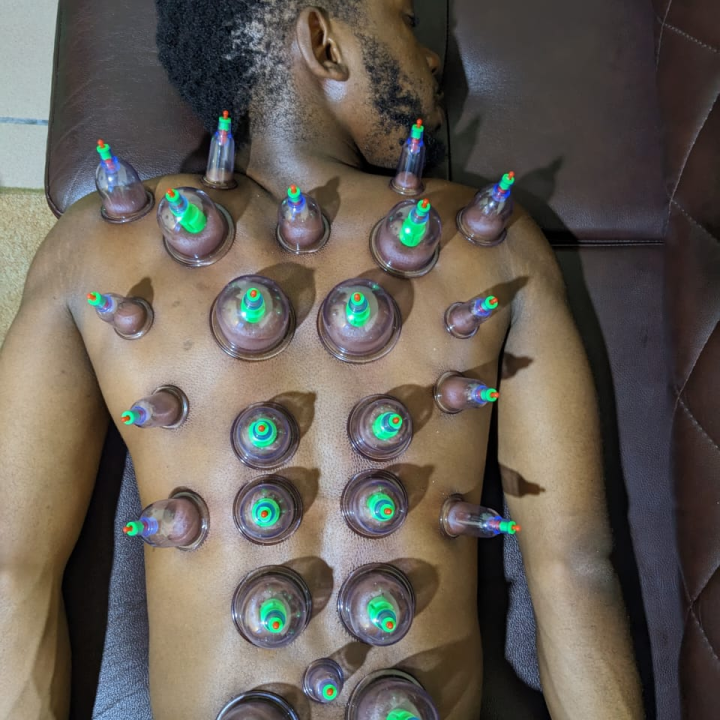 Hijama