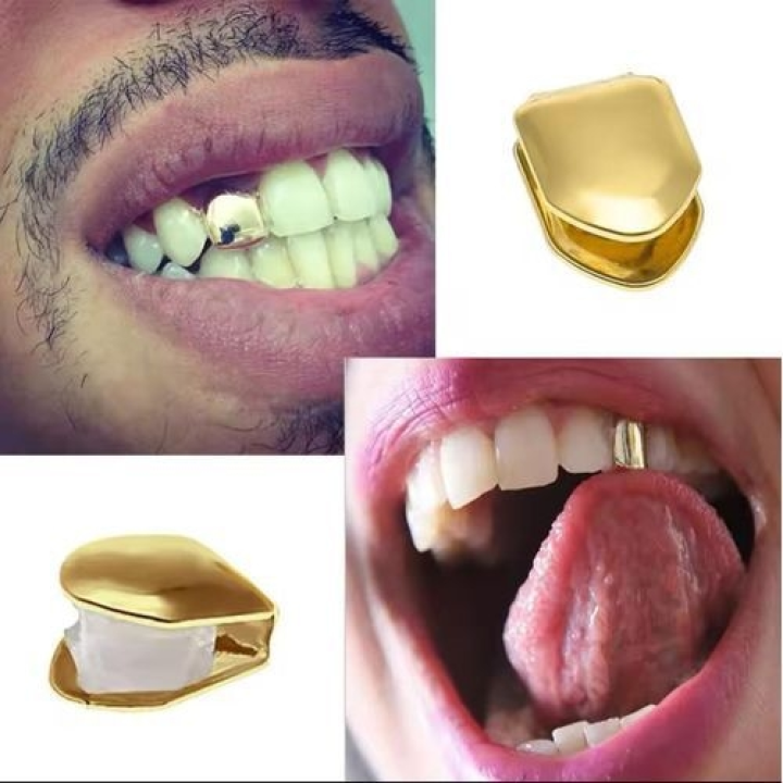 Gold tooth